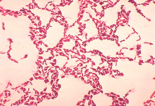 Бактерии рода Bacillus: современный статус и перспективы использования в качестве пробиотиков