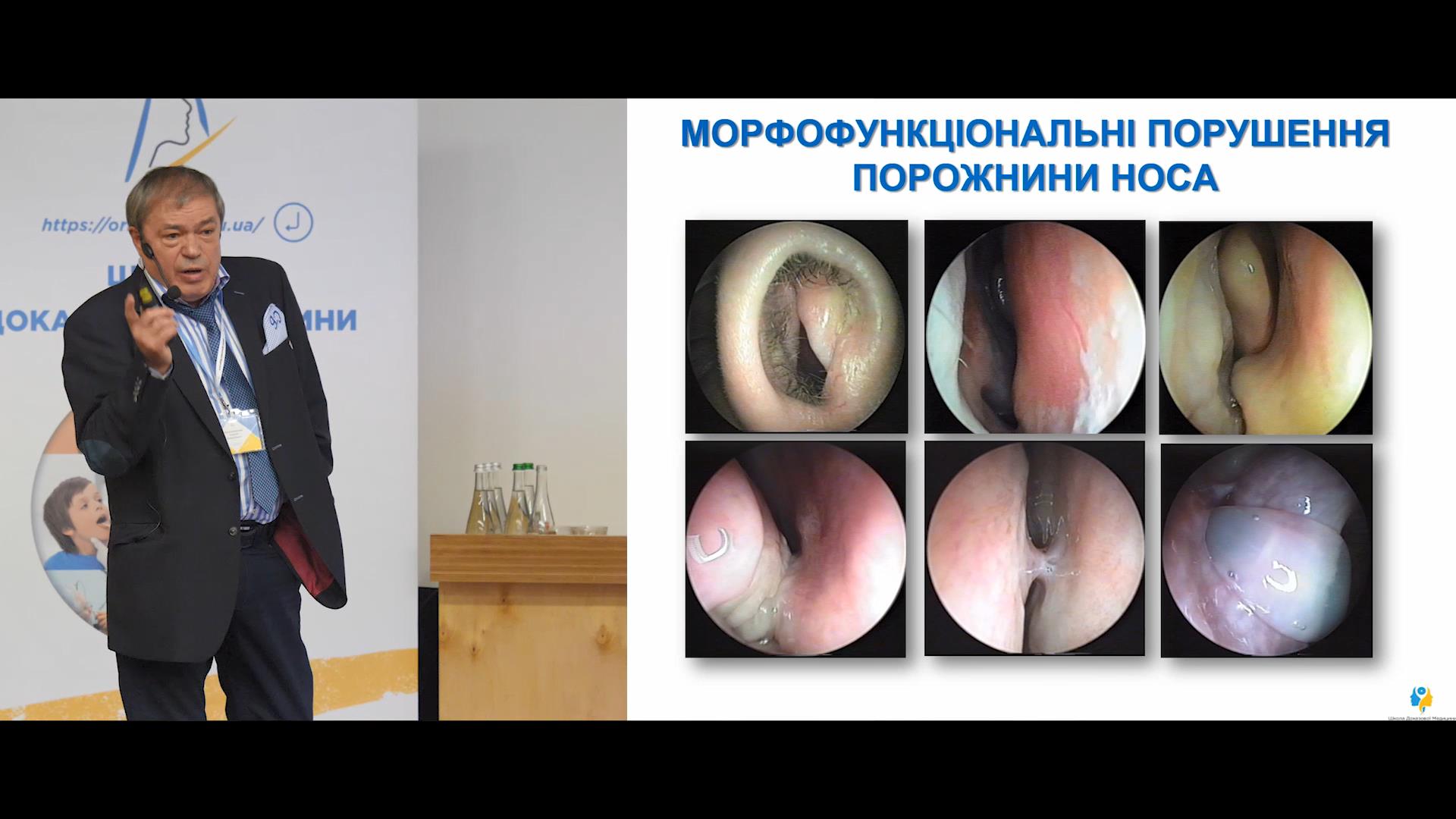 Морфологічні порушення порожнини носа