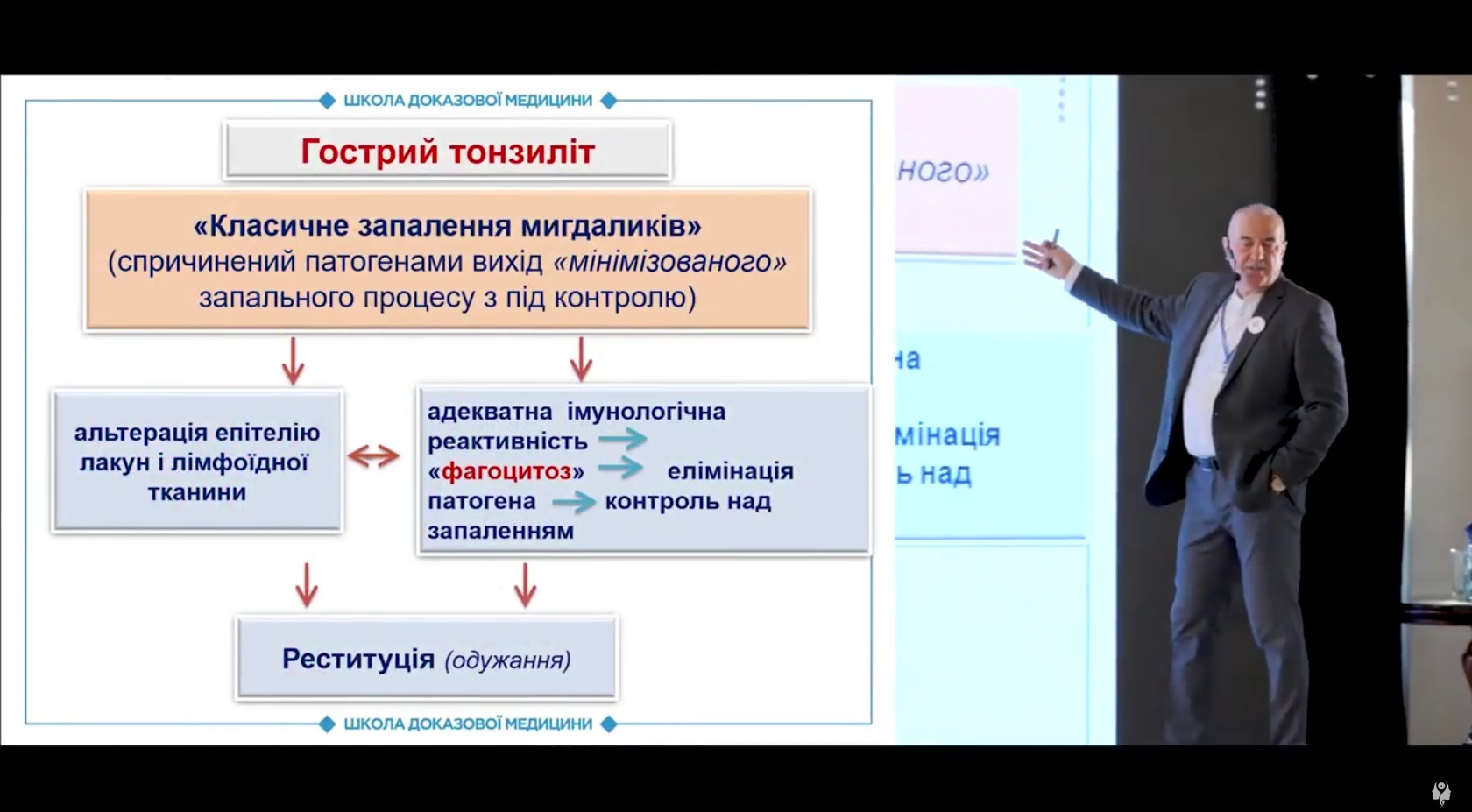 Гострий тонзиліт та фагоцитоз: формування рецидивуючого тонзиліту
