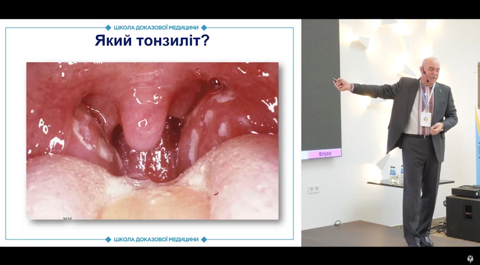 Етіологія та симптоми гострого тонзиліту