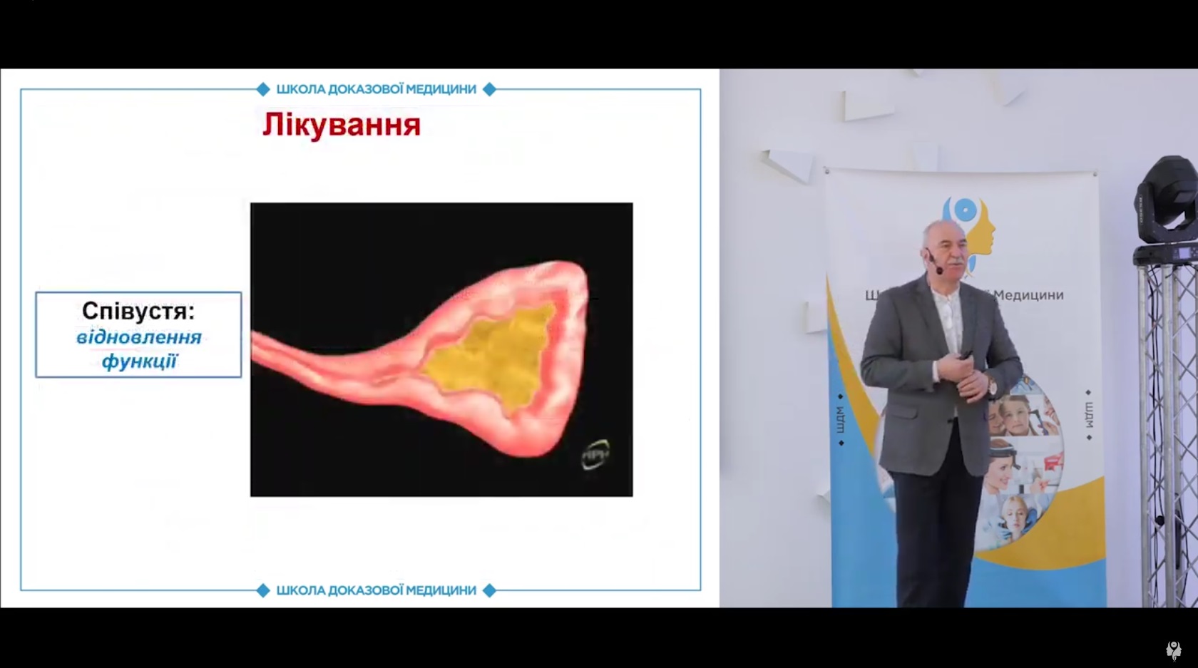 Принципи етіопатогенетичного лікування ХРС