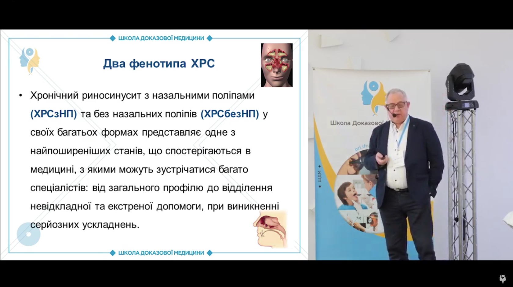 Фенотипи ХРС. Етіологія та патогенез