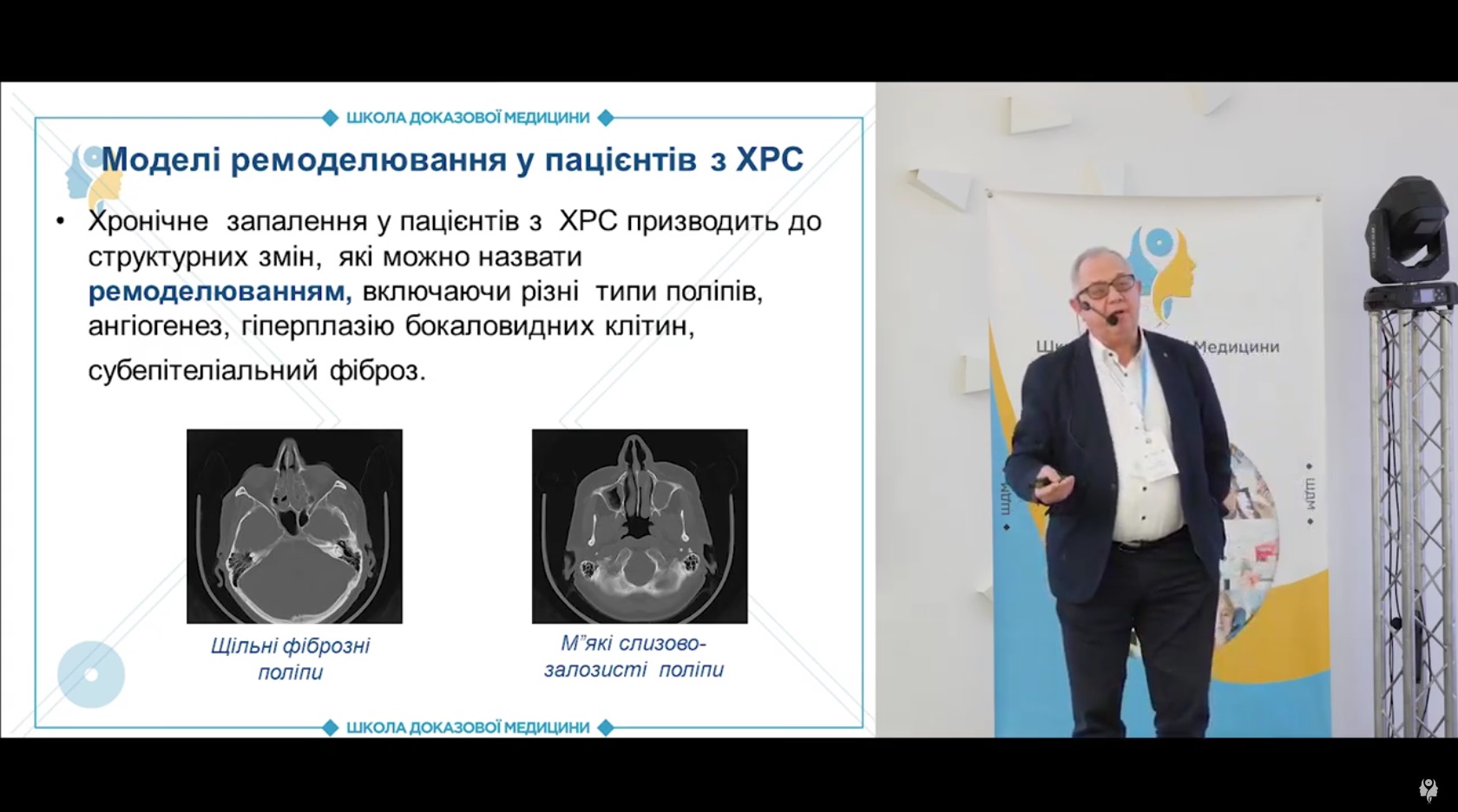 Моделі ремоделювання у пацієнтів з ХРС. Загальна характеристика патогенезу