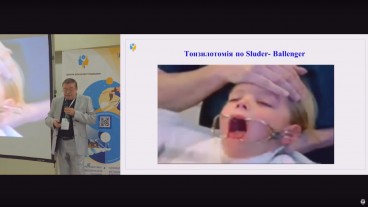 Покази до проведення тонзилектомії