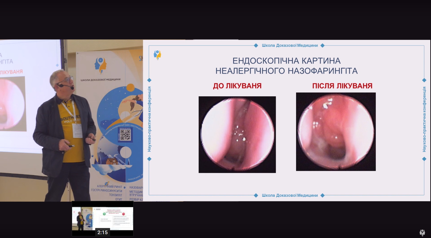 Кортикостероїдна терапія: вимоги
