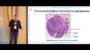 Патогенез гіпертрофії глоткового мигдалика