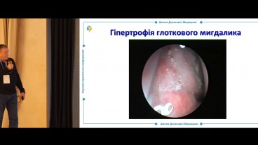 Показання до аденоїдектомії