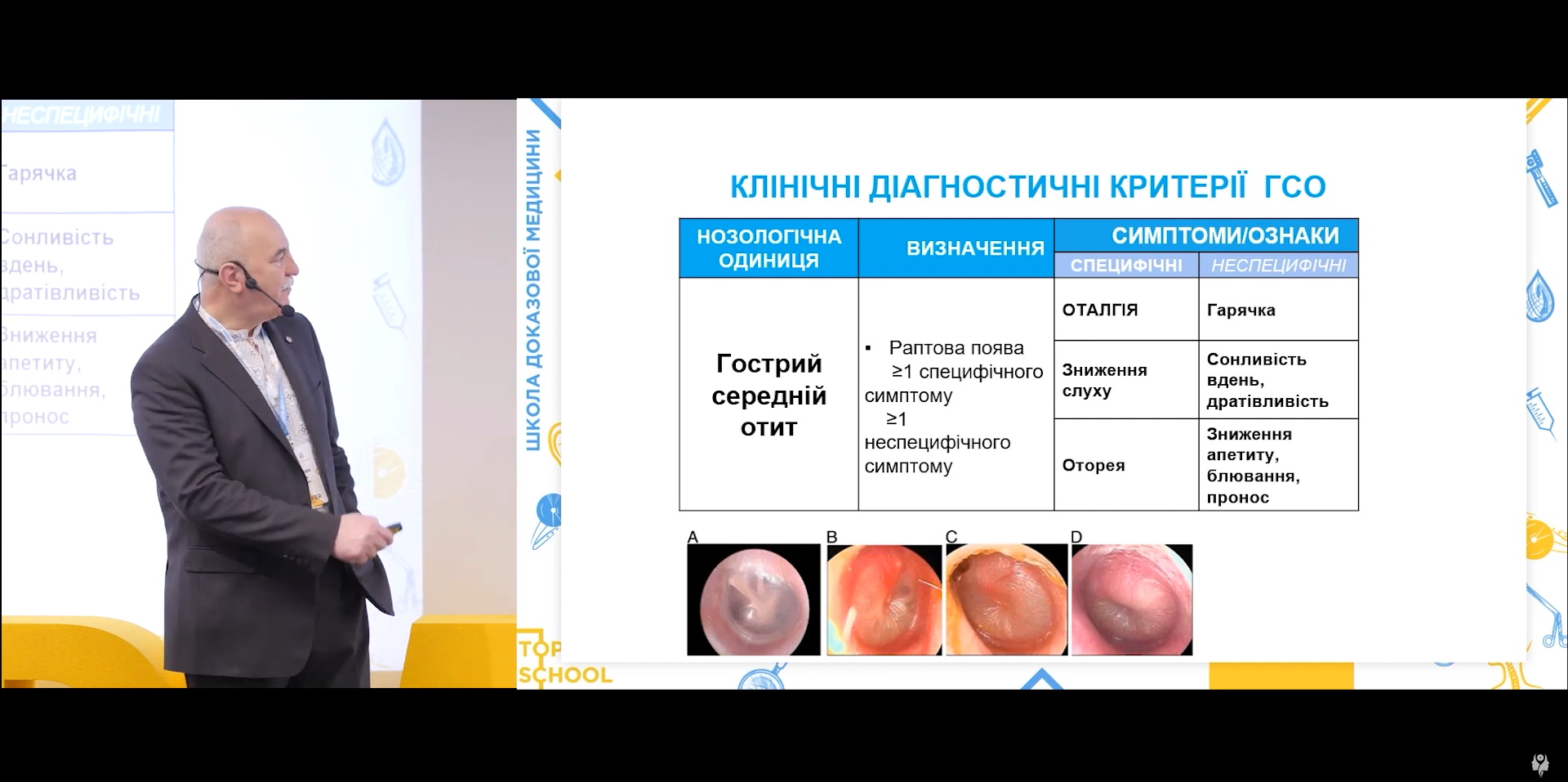 Обстеження пацієнтів з гострим тонзилітом