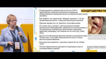 Хондродерматит: діагностика та лікування