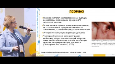 Псоріаз: діагностика та тригери розвитку