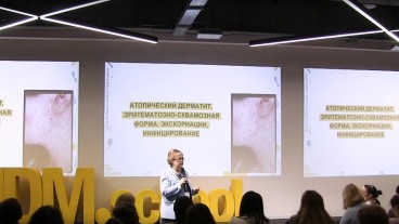 Атопічний дерматит: розповсюдженість, діагностика та лікування