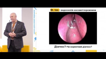 Клінічний випадок: ХРС без назального поліпозу