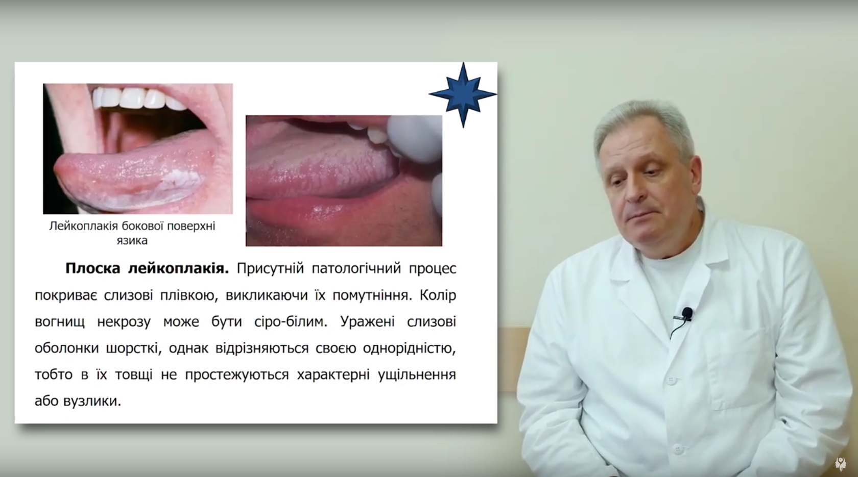 Лейкоплакія та онкопатологія слизової порожнини рота і губи