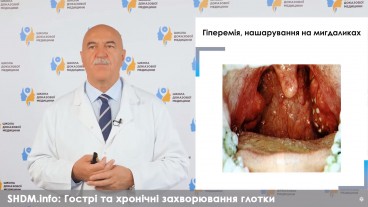 Етіопатогенез та діагностика запальних захворювань глотки Частина 2 