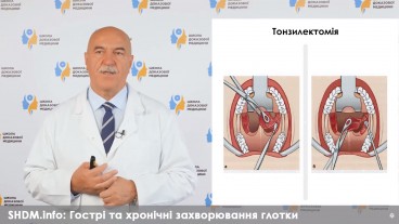 Лікування захворювань глотки. Частина третя