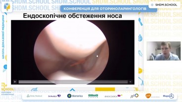 Методика ендоскопічного огляду