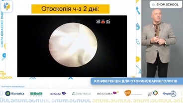 Клінічний випадок: хронічний назофарингіт і гострий середній отит