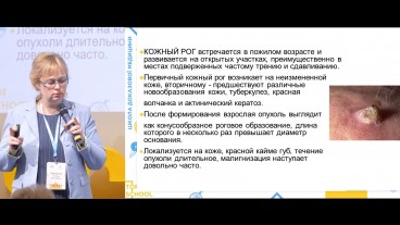 Шкірний ріг як одна з форм актинічного дерматозу
