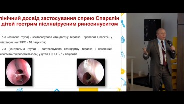 Іноваційні технології в іригаційній терапії гострого та хронічного риносинуситу