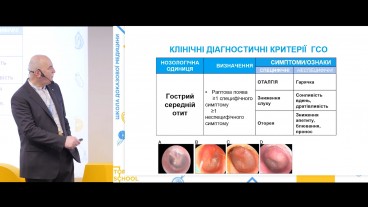 Обстеження пацієнтів з гострим тонзилітом