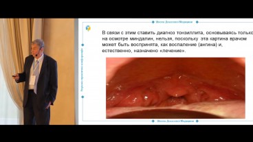 Фізіологічне запалення чи гострий тонзиліт?