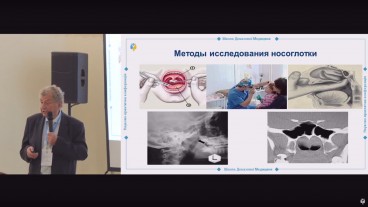 Дослідження носоглотки. Методи проведення аденотомії у дітей