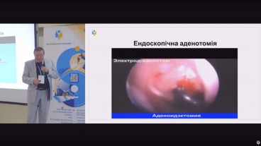 Аденотомія, тонзилектомія, тонзилотомія методи проведення