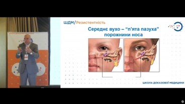 Особливості перебігу ГРС і ГСО