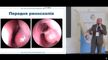 Назальна обструкція та виділення з носа при ГРС, або колір не важливий (!)