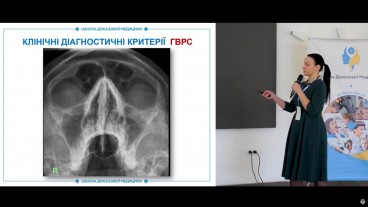 Комп'ютерна томографія як метод вибору для дослідження функціонального стану співусть пазух