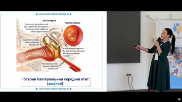 Оцінка функції співусть пазух для визначення форми гострого риносинуситу