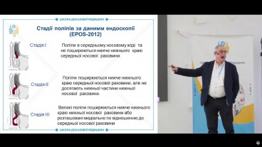 Стадії поліпів за даними ендоскопії (ЕРОS-2012)