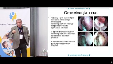 Комплексне лікування риносинуситів: деякі засади