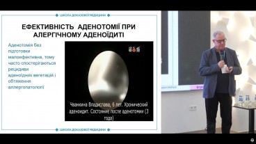 Аденотомія у дітей з алергічним НФ