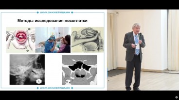 Аденоїди: що має знати лікар