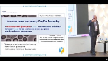Лікування рецидивуючого/рекурентного тонзиліту