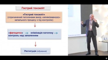 Патогенетична терапія гострого тонзиліту
