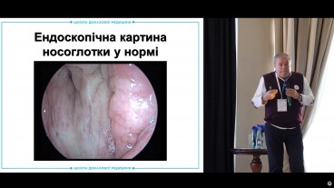 Діагностика та патогенез хвороб глоткового мигдалика