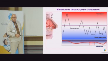 Як довго продовжувати лікування алергічного риніту?