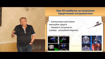 Як лікувати поліпи?