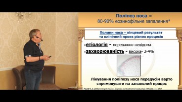 Що таке поліпоз носа?