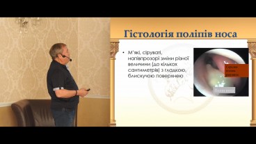 Патогенез, гістологія та цитологія поліпів