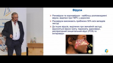Механізми запалення при гострому риносинуситі