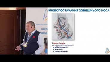 Носові кровотечі