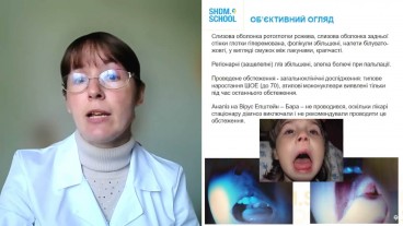 Вірус Епштейна Бар і хронічні хвороби мигдаликів