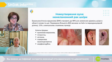 Від екземи до інфекції: алгоритм взаємодії отоларинголога та дерматолога